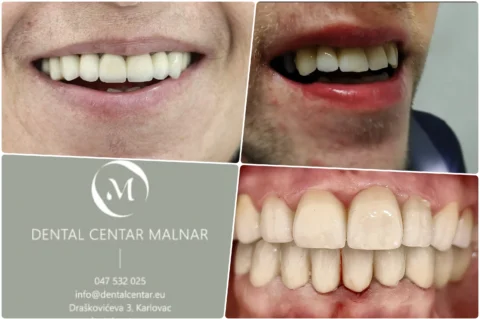 dental centar malnar foto